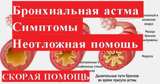 Внимание! Вся информация в видео только для ознакомительных целей! При возникновении каких либо симптомов вызывается скорая медицинская помощь!