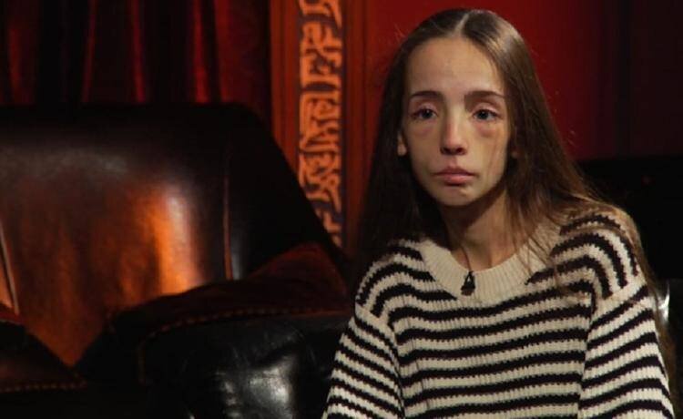 Елена тимашева битва экстрасенсов. Катя яковлева битва экстрасенсов. Героиня битвы экстрасенсов с пятном на лице. Мария куликова в фильме поворот ключа. Битва экстрасенсов анорексичка катя яковлева.