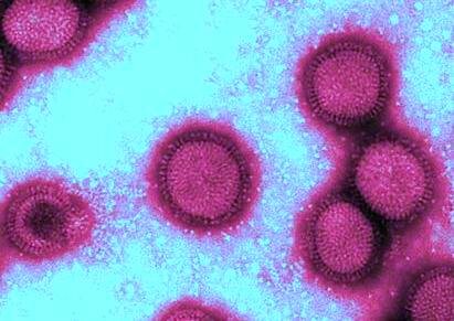 H1N1