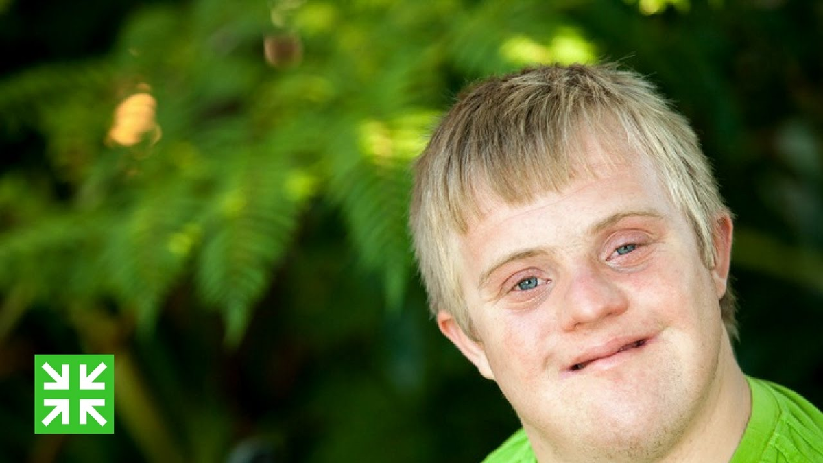 Типичный артодаун https://i.ytimg.com/vi/KJfg-fmP3f4/maxresdefault.jpg