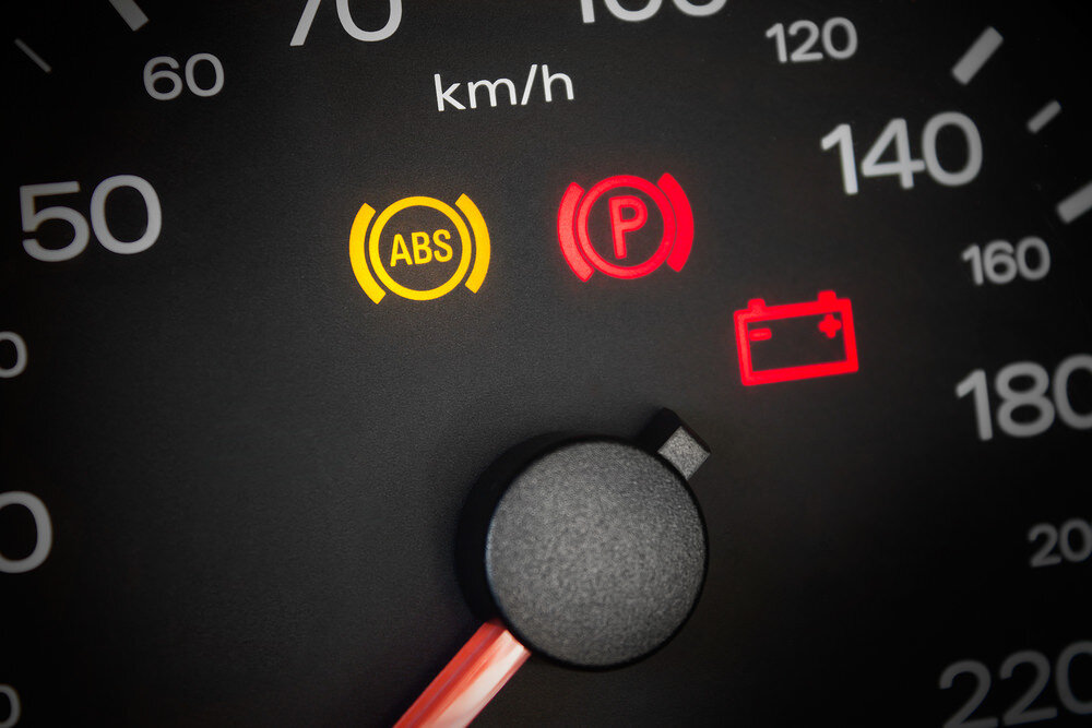 Источник: https://www.yourmechanic.com/article/5-essential-things-to-know-about-your-car-s-anti-lock-braking-system-abs