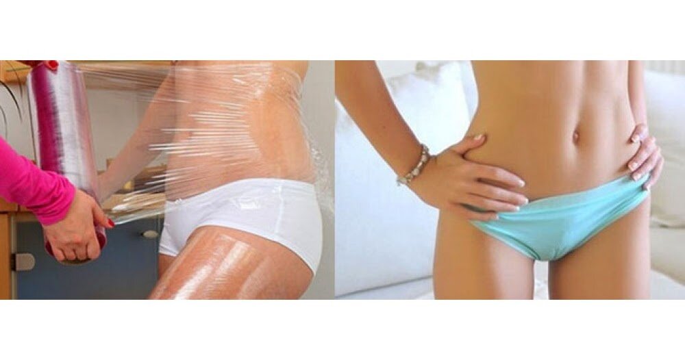                                   Обертывание пищевой пленкой для похудения.