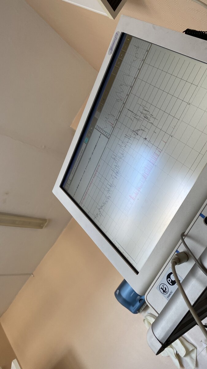 Мой монитор, за которым я наблюдаю все время исследования…