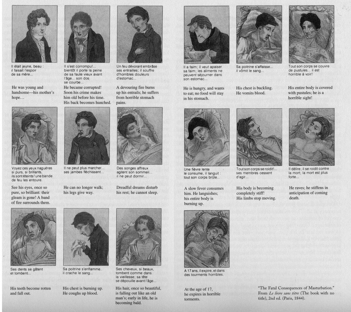 Книга The Fatal Consequences of Masturbation (Париж, 1844 год)