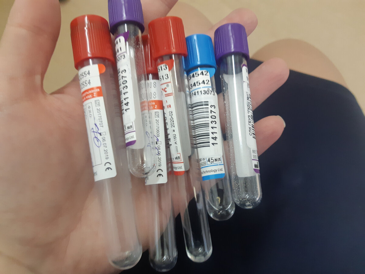 Фото автора. Это не самое большое количество, было и побольше за раз.