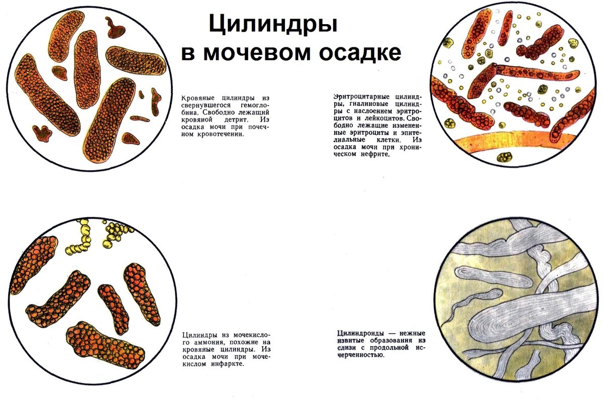 Микроскопическое исследование секрета предстательной железы