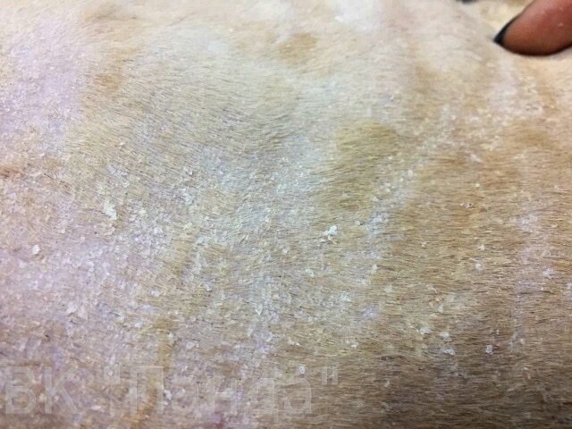 Перхоть на поверхности кожи