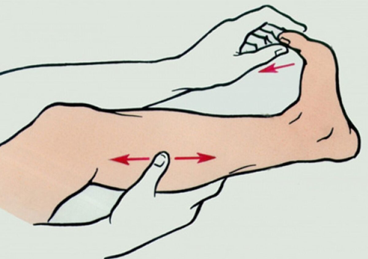 Женское плечо. Судорога в предплечье. Предплечье правой руки. Предплечье правой руки. Невропатия лучевого нерва руки.