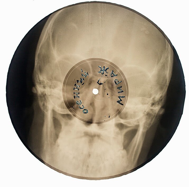 Источник: http://morbidanatomy.blogspot.com/2015/04/x-ray-audio-guest-post-by-stephen.html?showComment=1430163391425