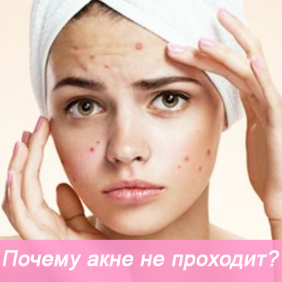 почему акне не проходит