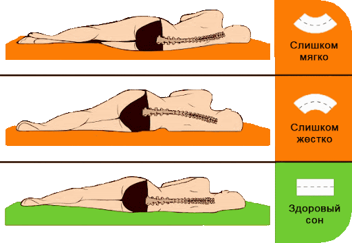 Положение позвоночника взрослого человека в зависимости от жесткости матраса.
