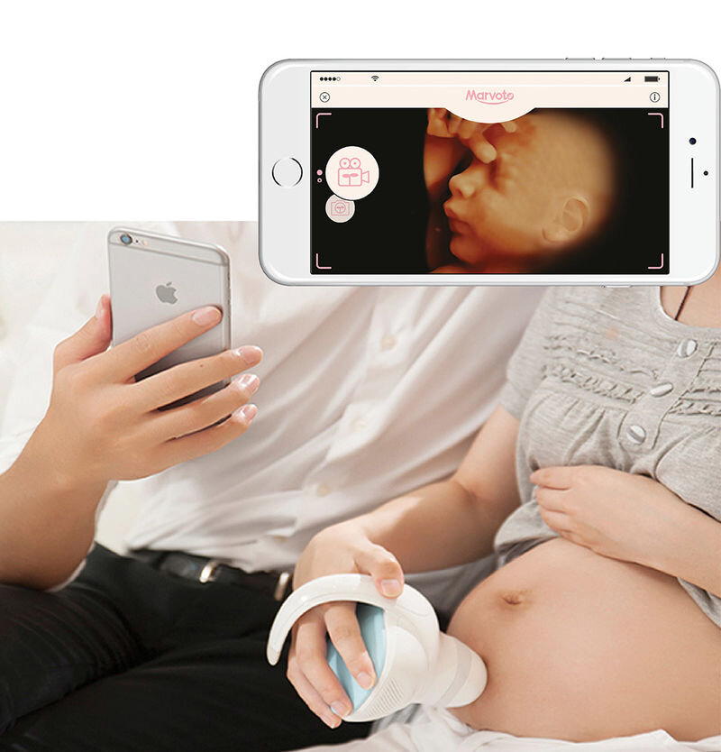   « Smart Baby Camera » позволяет родителям смотреть на ребенка  в утробе матери Родителям сегодня достаточно повезло, что они живут в то время, когда они могут наблюдать за своим будущим ребенком в