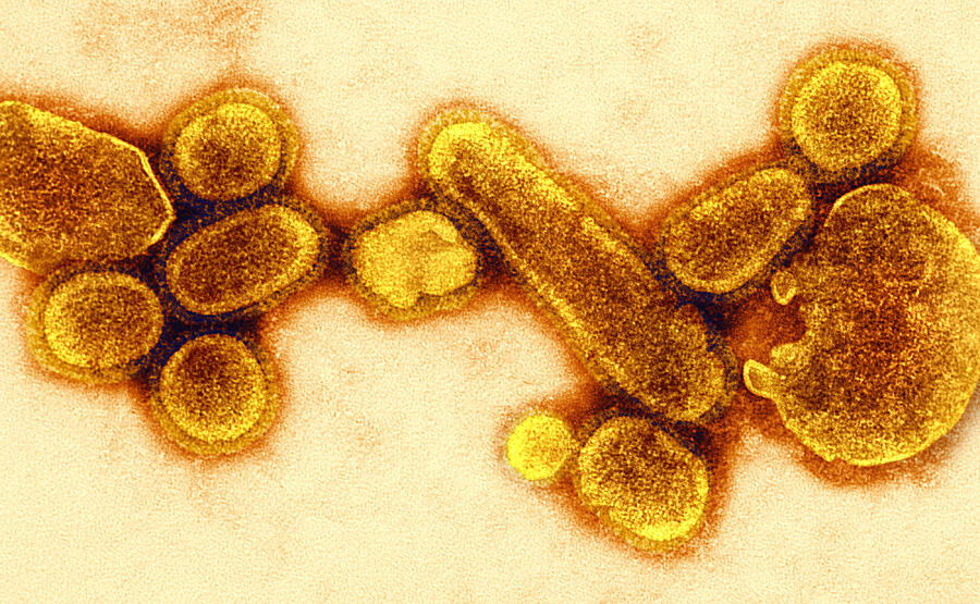 h1n1 1918 года.