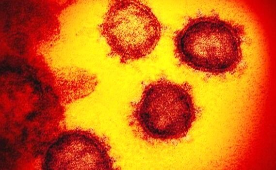 Снимок COVID-19 под микроскопом