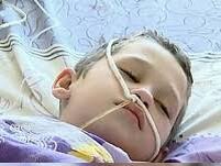 Синдром Рея, кома