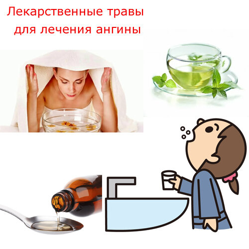 Лечение ангины лекарственными травами