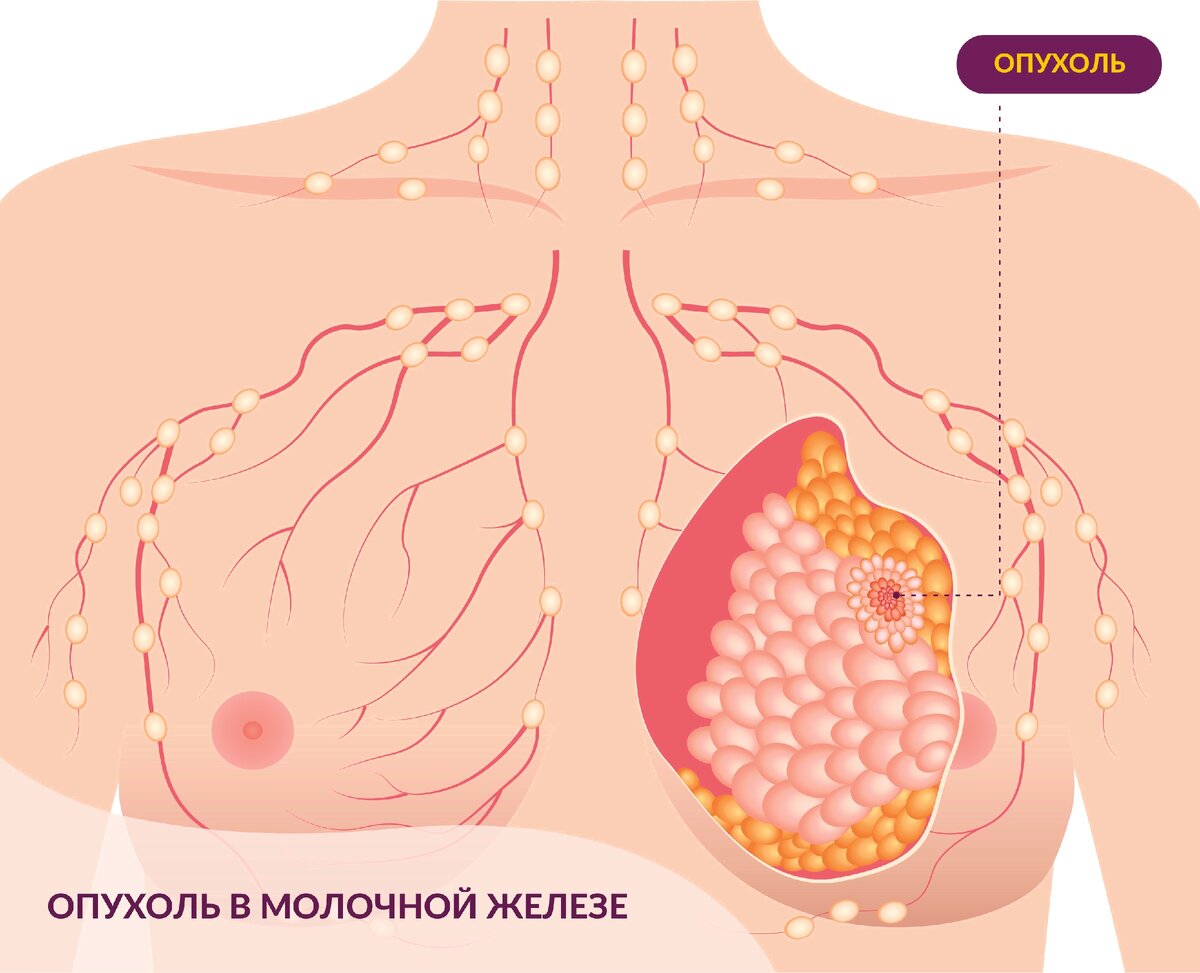 что такое тахикардия может ли болеть в груди фото 116