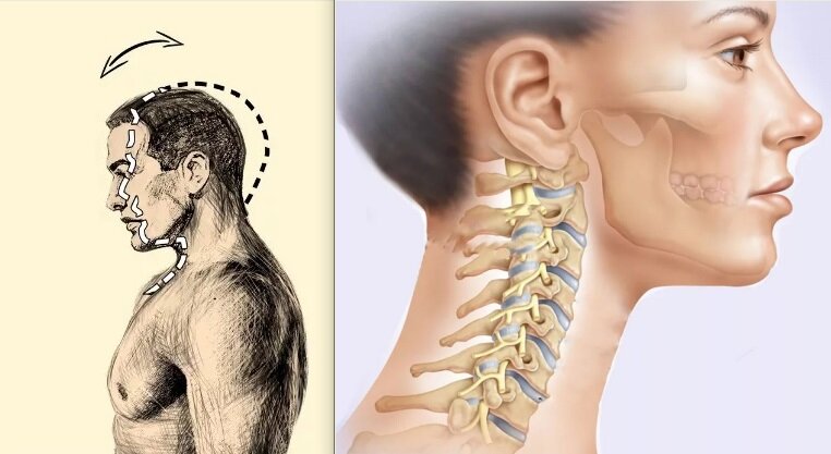 гитт шейный остеохондроз. упражнения для мозгового кровообращения при шейном остеохондрозе. упражнения гитта для спины. гитт шейный остеохондроз. гимнастика виталий гитт.