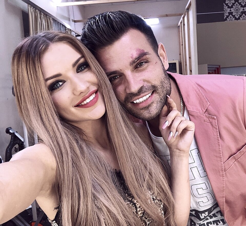 Руслан считает родимое пятно своей изюминкой 
Фото: «Инстаграм»