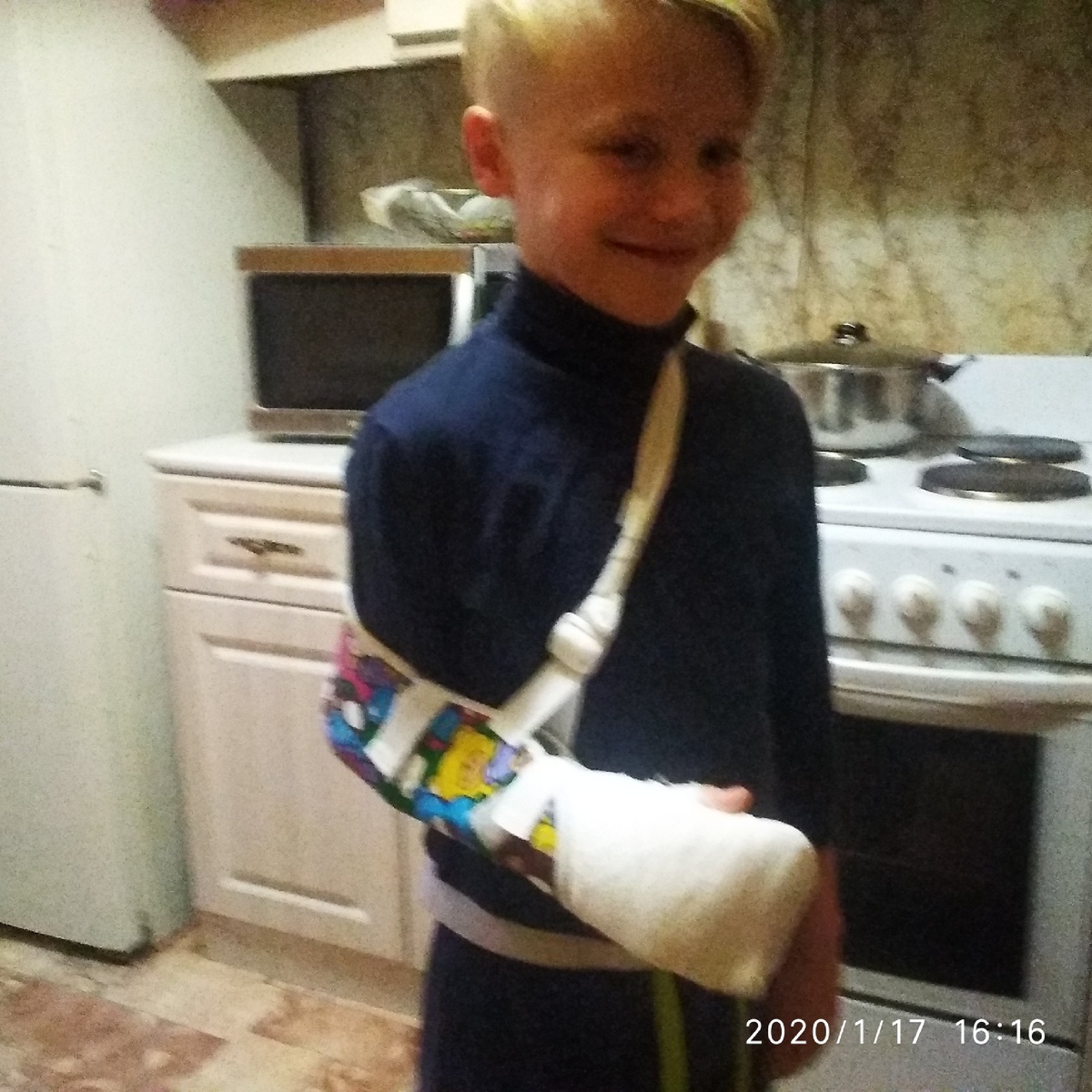 Мой внук сломал два пальца