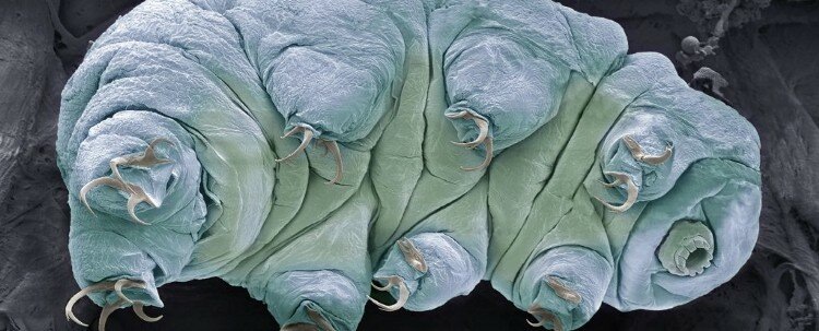 (Steve Gschmeissner/Science Photo Library)