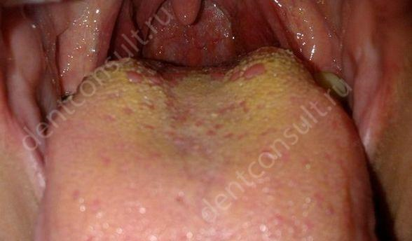 Фото: dentconsult.ru