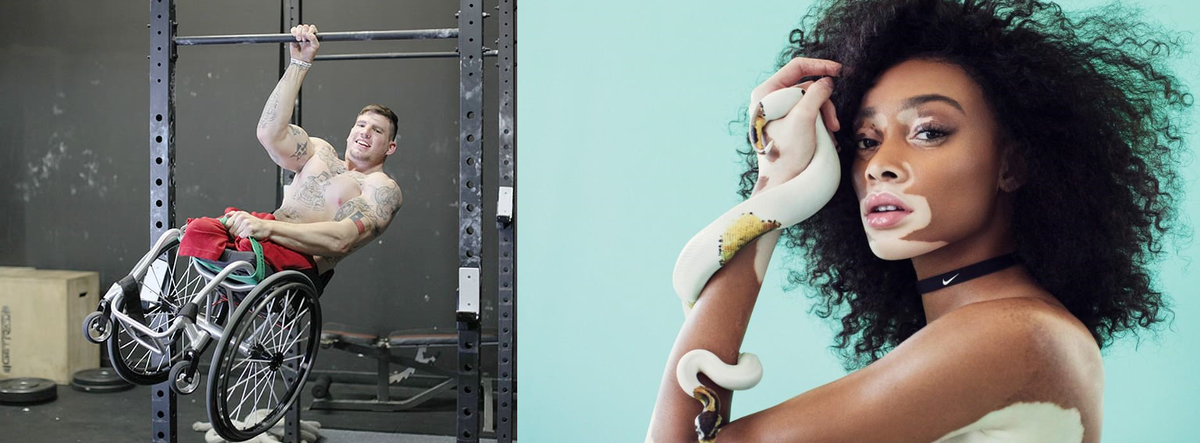 Витилиго и инвалидность. Источник: https://yandex.ru/images/search