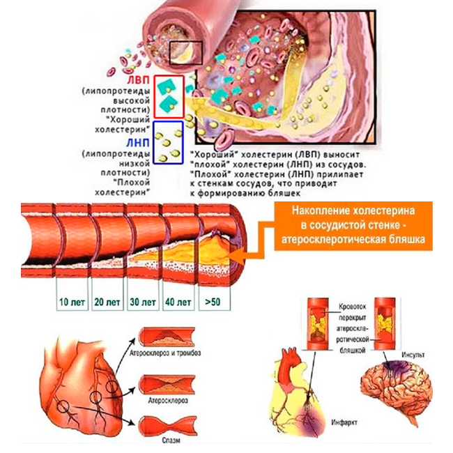 Все что нужно знать о холестерине