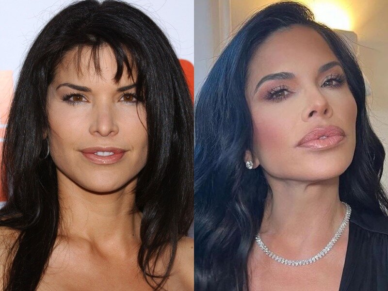 Лорен санчес до и после пластики Lauren Sanchez's Plastic Surgery Botox, Facelift, Breast Implants & Lip Filler