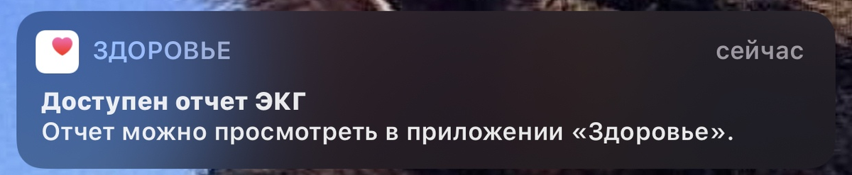 Отчет об ЭКГ доступен сразу на iPhone в развернутом варианте.