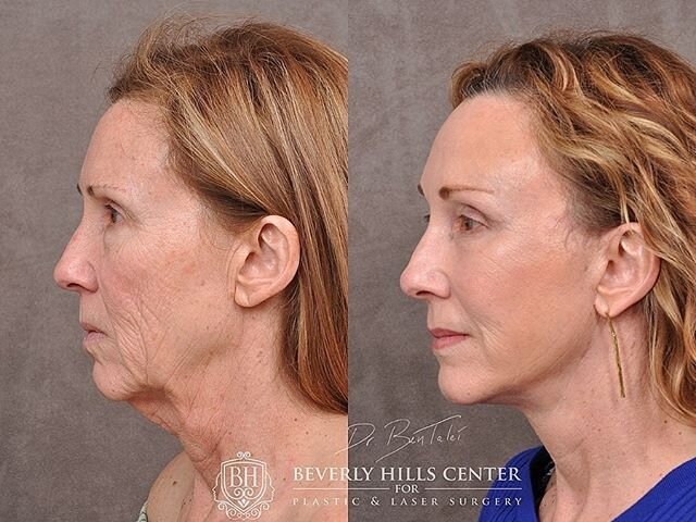 фото: @drbentalei