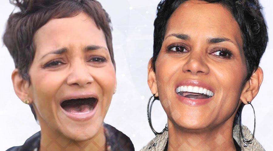 Конечно, актрисе Холли Берри не нужна была тотальная имплантация – причина ее беззубости в фотошопе. 😁 Но даже если у вас действительно нет зубов, достигнуть голливудского результата можно разными путями! Фото: Яндекс.Картинки.