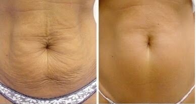 Источник изображения: https://yandex.ru/images/