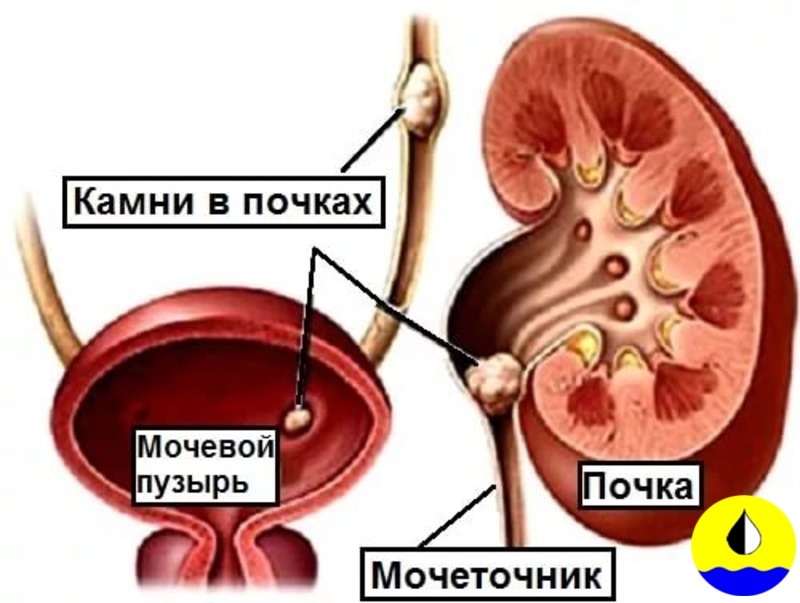 Фото из открытого источника.