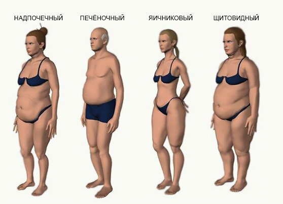 Типы телосложения