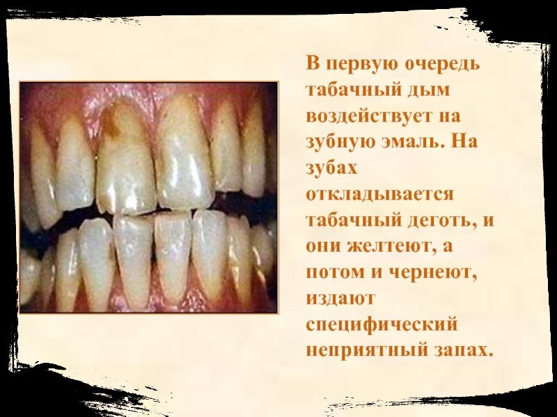 Вред от табака