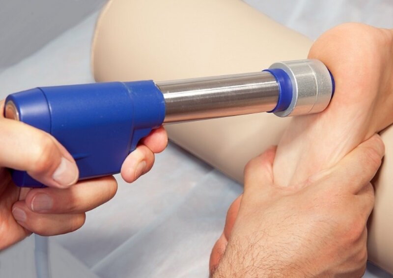 Применение аппарата УВТ для лечения пяточной шпоры.