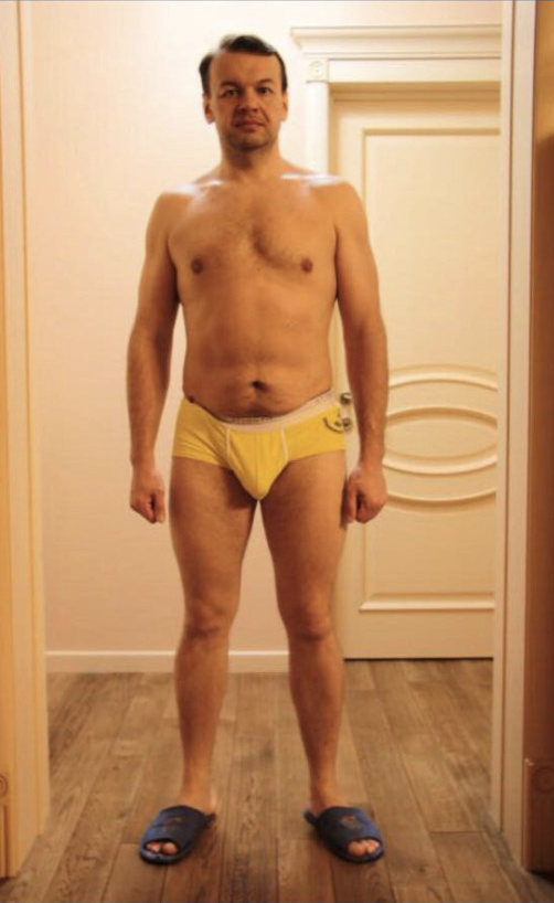 Лишний вес, характерная для гипотериоза одутловатость лица... Анализы подтвердили наши догадки: щитовидка не в норме.