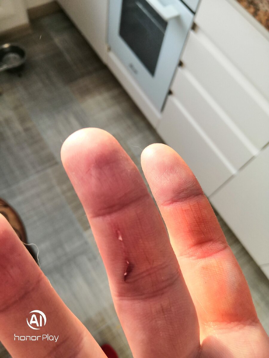 Это она укусила, когда я попробовал её погладить. В это время Дарки грызла косточку. Во время укуса ей было 3 месяца.