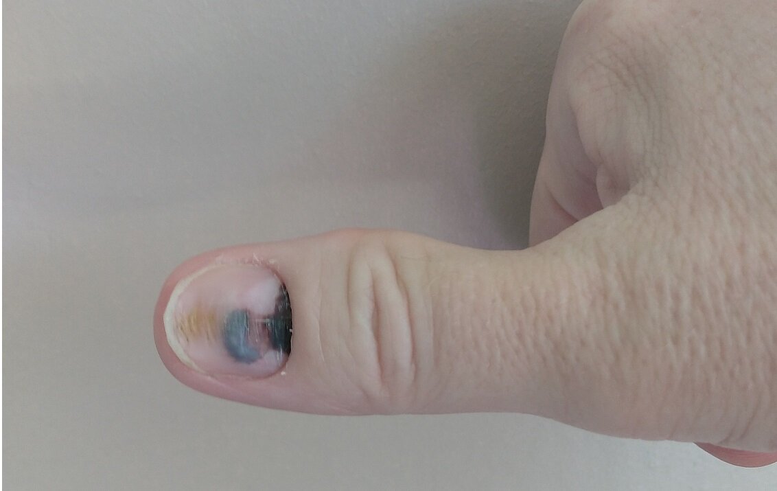 Мелочь, но неприятно )))