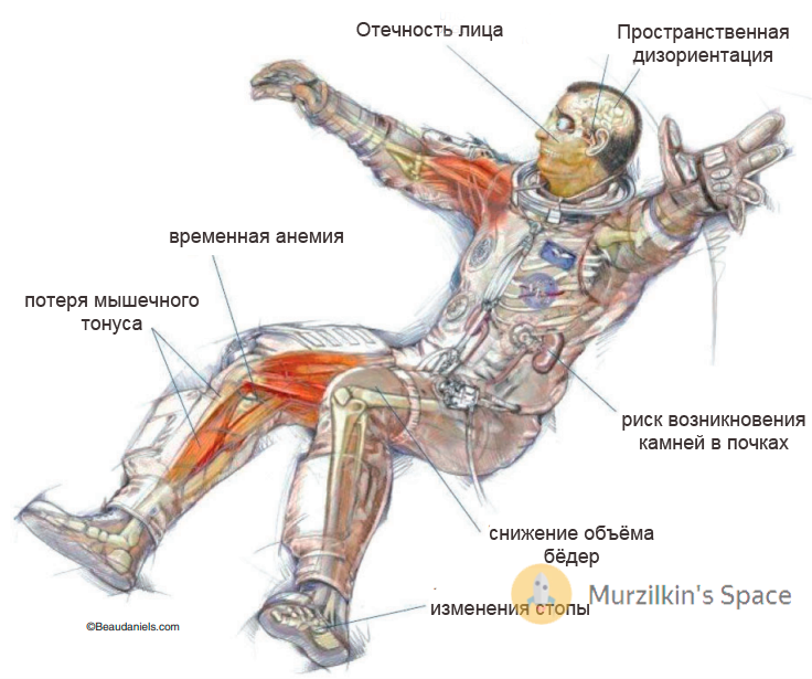 Влияние условий космического полета на организм человека презентация