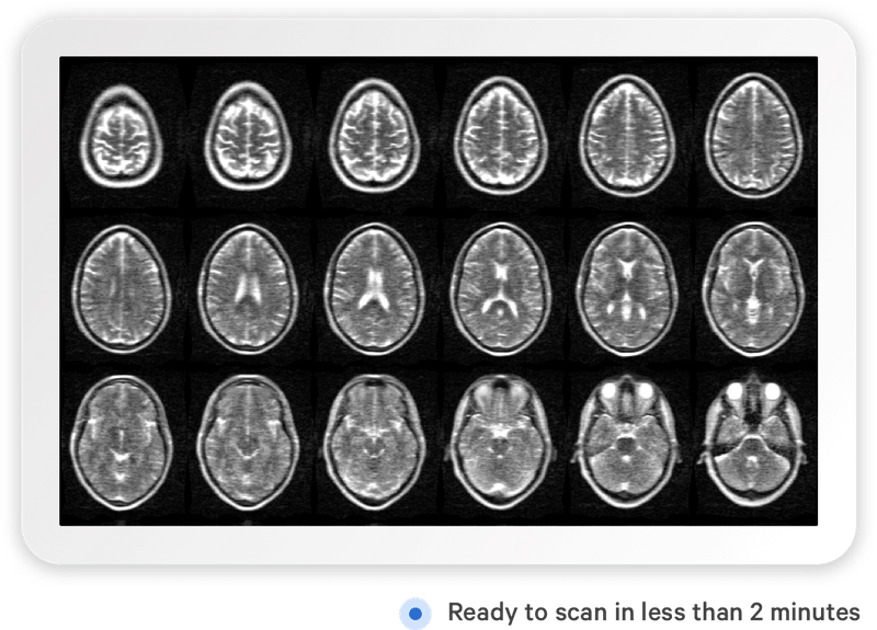 Фото: hyperfine.io