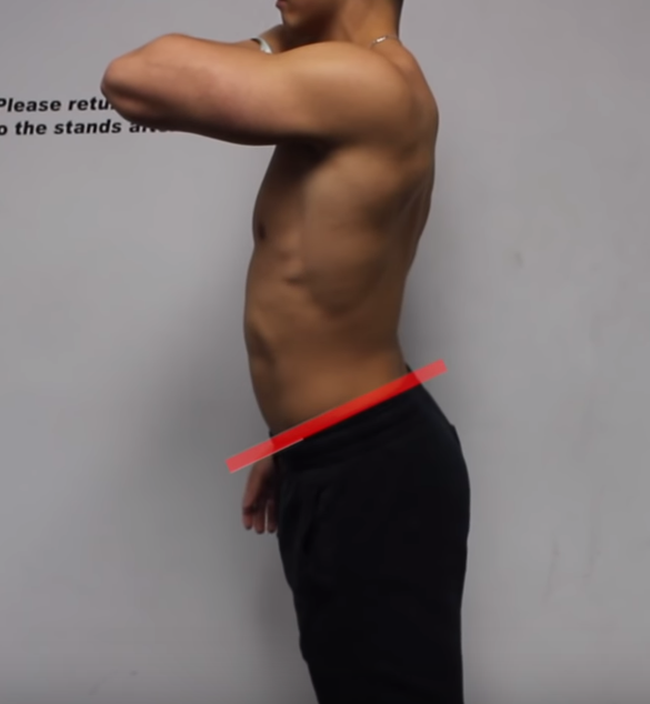 Лордоз поясничного отдела.