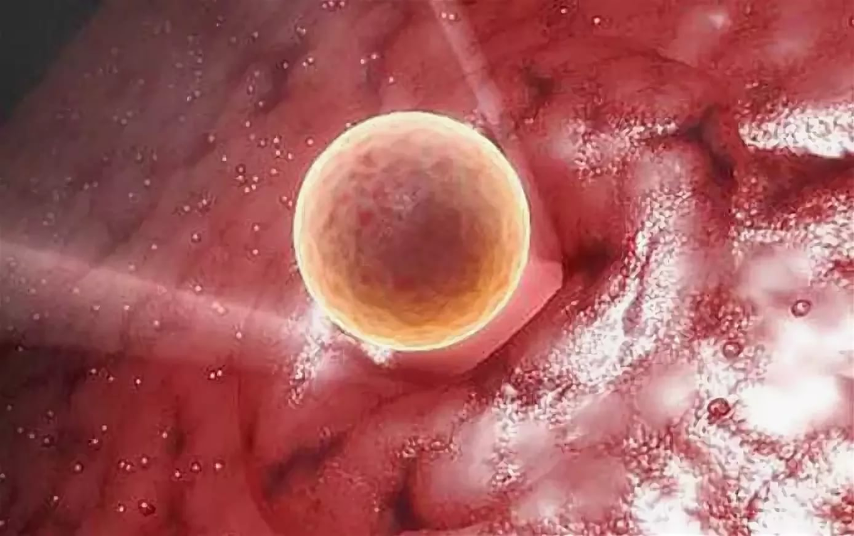 Овуляцией называется выход яйцеклетки. Яйцеклетка после овуляции. Яйцеклетка созревает в. Блуждающая яйцеклетка.