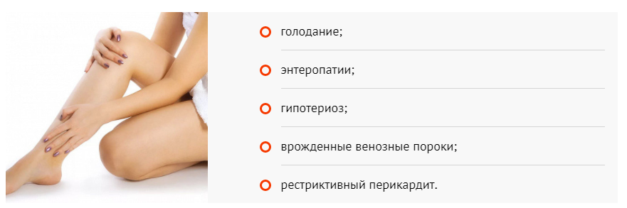 Как убрать отеки на ногах у женщины