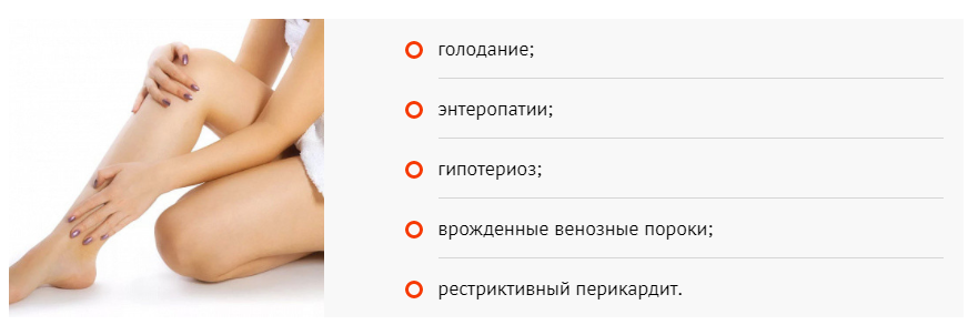 Отеки ног причины у женщин после 60. Отёки ног причины у женщин. Отекают ноги причины у женщин. Отекают ноги причины у женщин после 60.