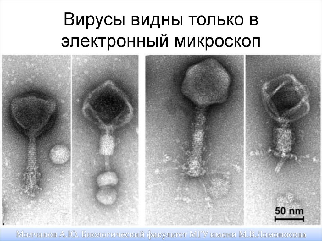 Как выглядит бактериофаг под микроскопом Вирус как Вираж Екатерина Маркова Дзен