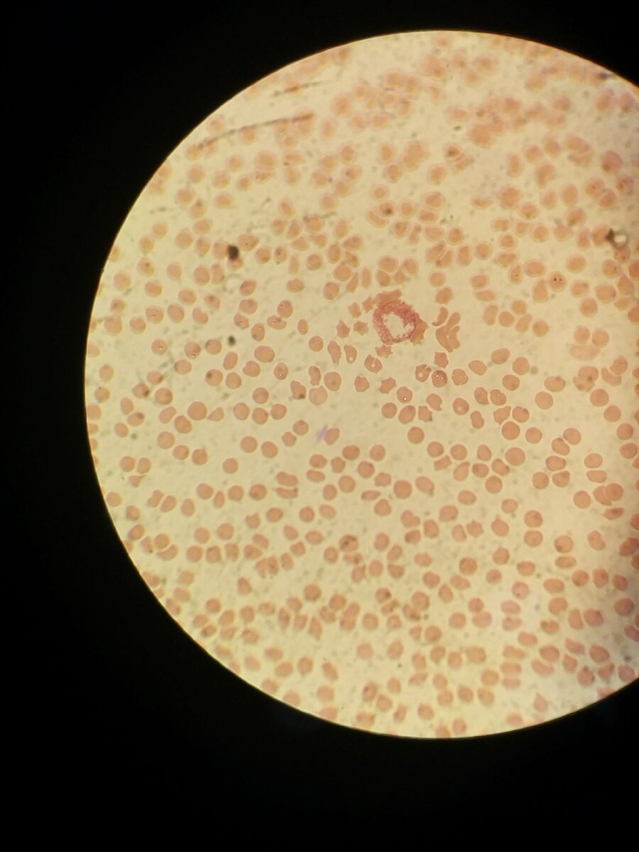 Окрашенный препарат крови собаки для подсчета лейкоцитарной формулы