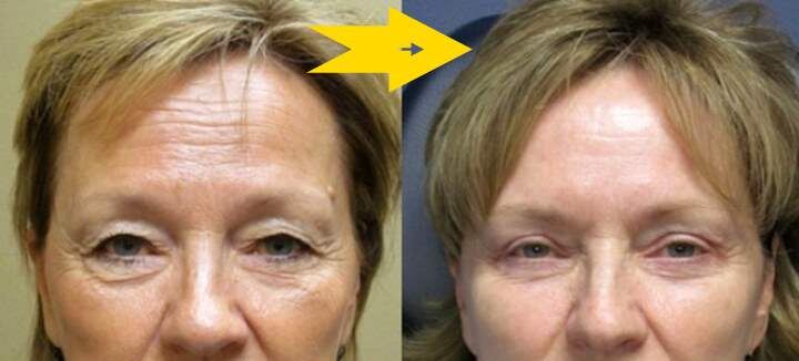 Простое домашнее омоложение лица.