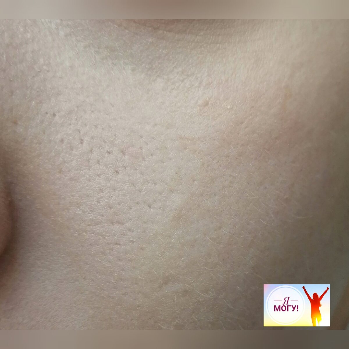 Личное фото автора канала "Я Могу!".Спустя около полугода применения описываемого бальзама